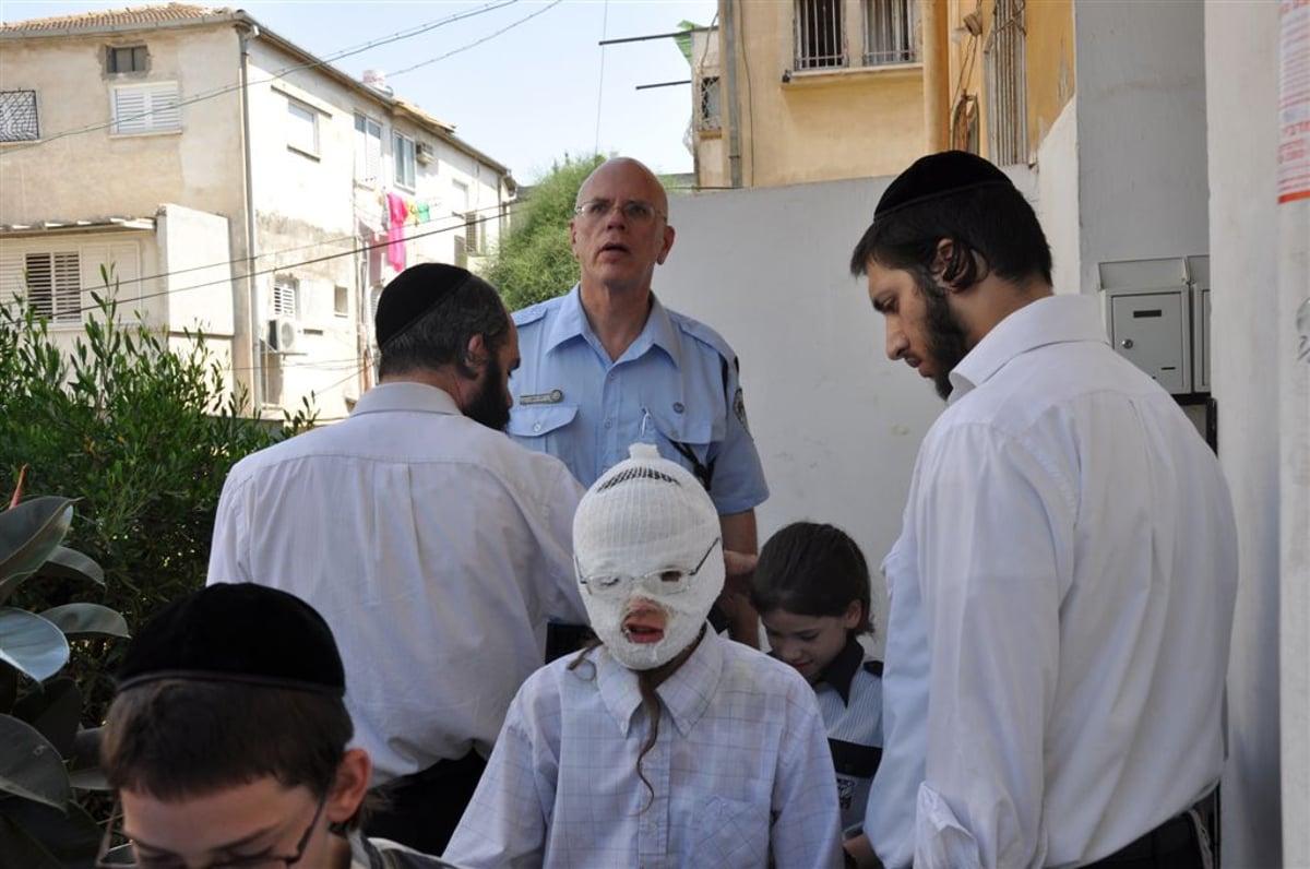 פיצוץ עז בבני-ברק, ילדים נכוו קשות