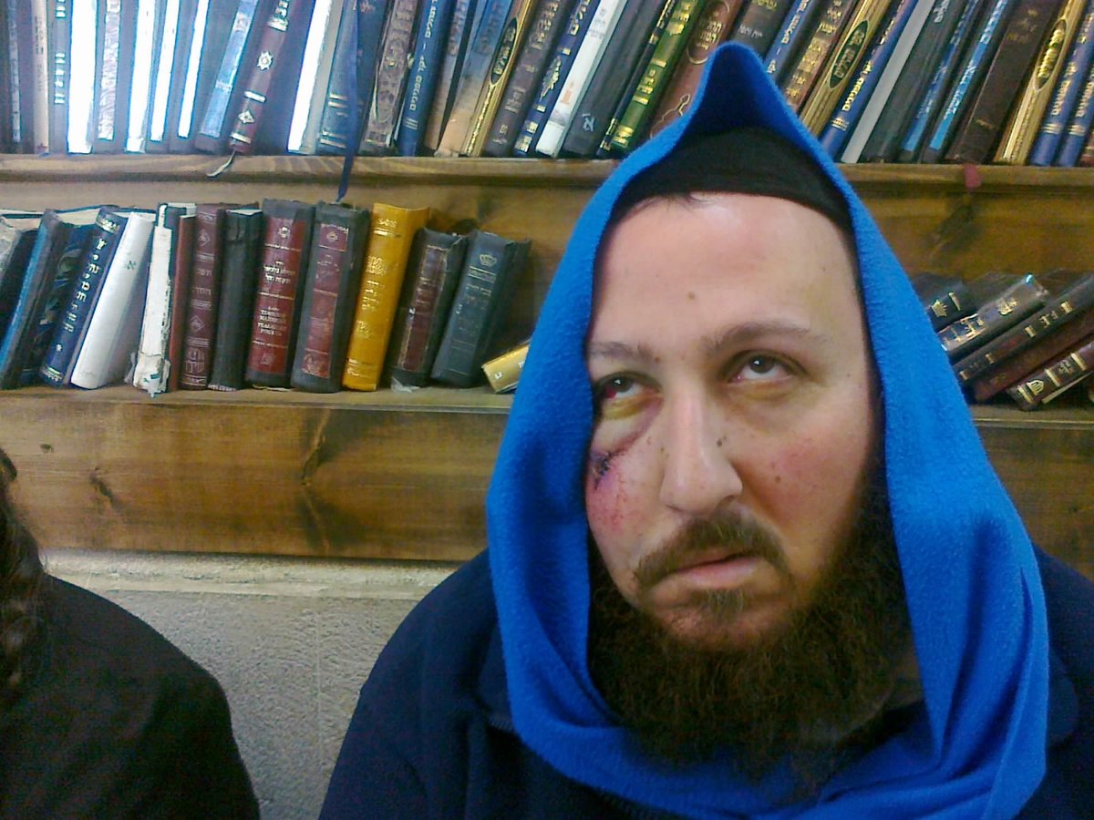 מחריד: מתפלל הותקף בקבר שמעון הצדיק