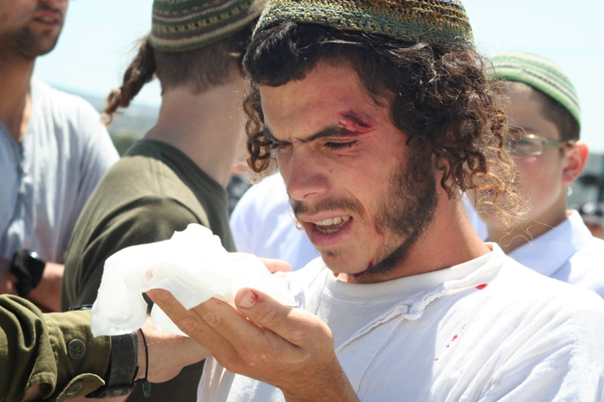 תיעוד מצולם: ההלם, הזעם, ההפגנות