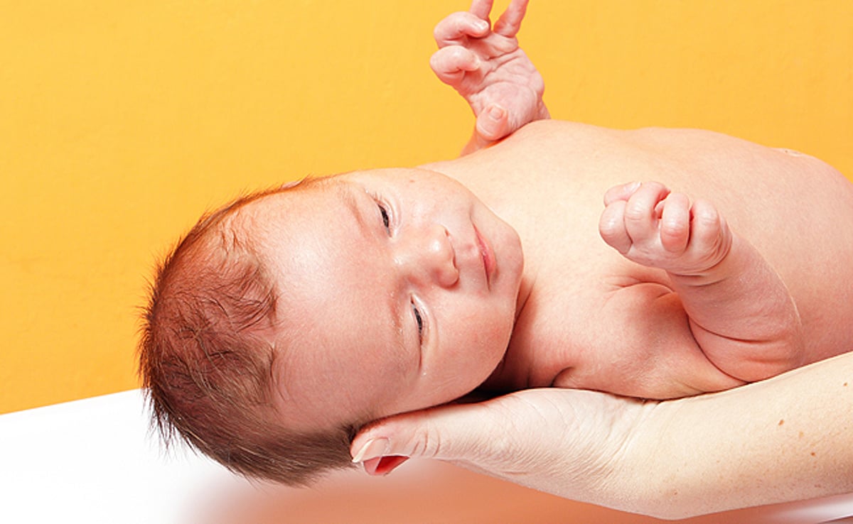 מחקר דרמטי: התינוקות בחיפה נולדים עם ראשים קטנים