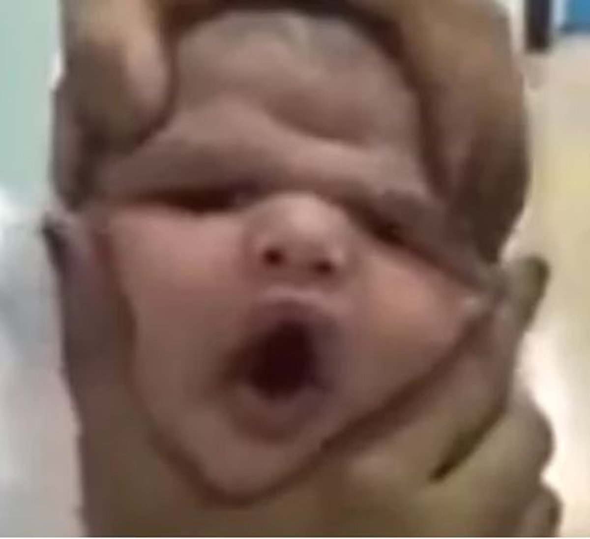 אחיות בבית החולים מחצו ומעכו פנים של תינוק אומלל