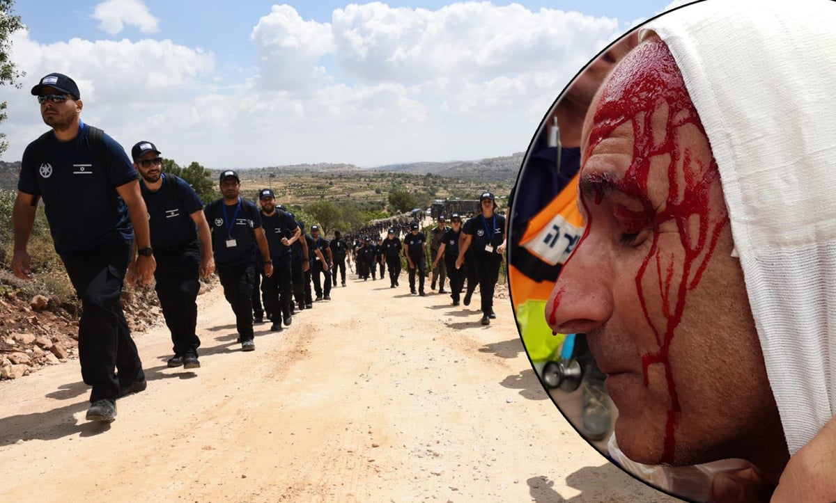 המשטרה: נתקלנו באלימות חמורה • תיעוד