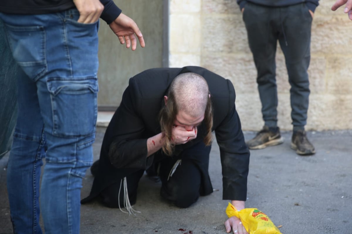 שוב: שלושה עצורים בהפגנה נגד הרכבת הקלה • תיעוד