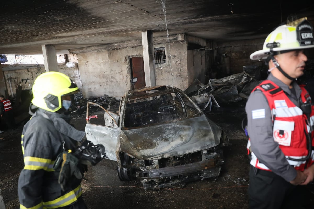 פצועת השריפה בירושלים: "הייתי בטוחה שאני הולכת למות"