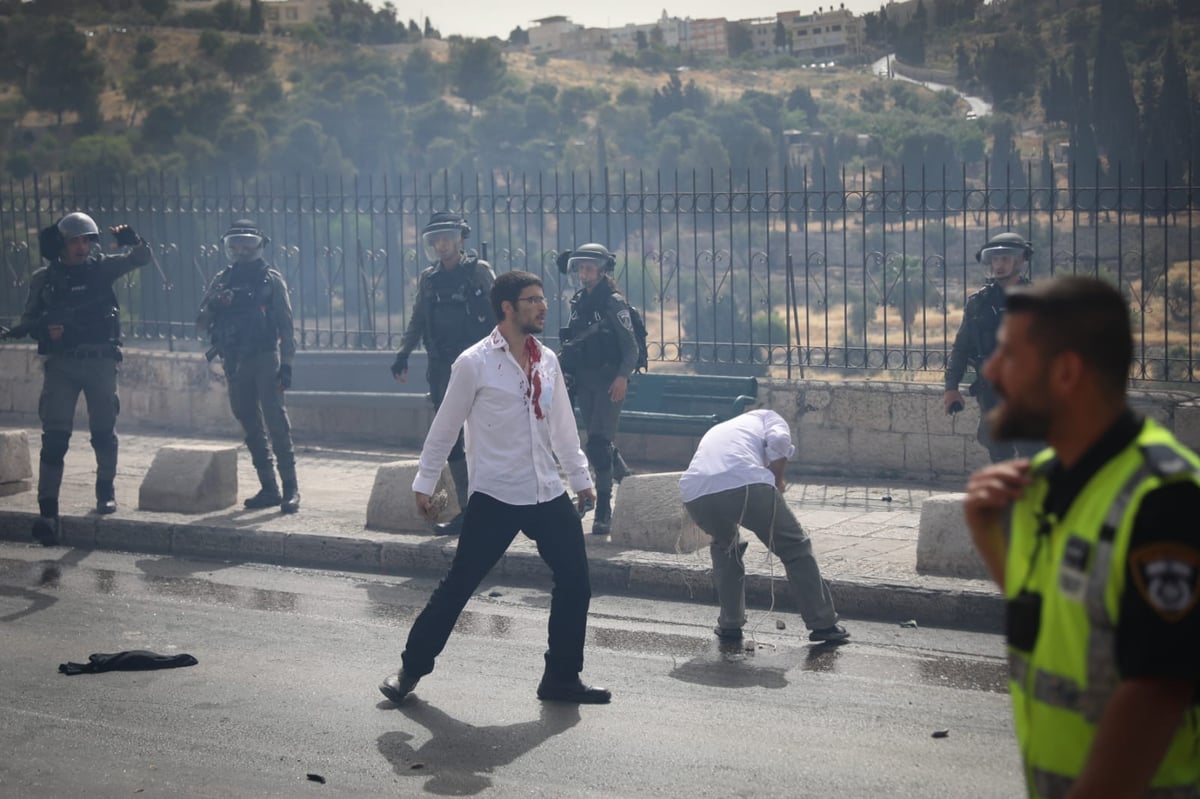 תיעוד דרמטי מירושלים: יהודים ניצלו מלינץ' בשער האריות