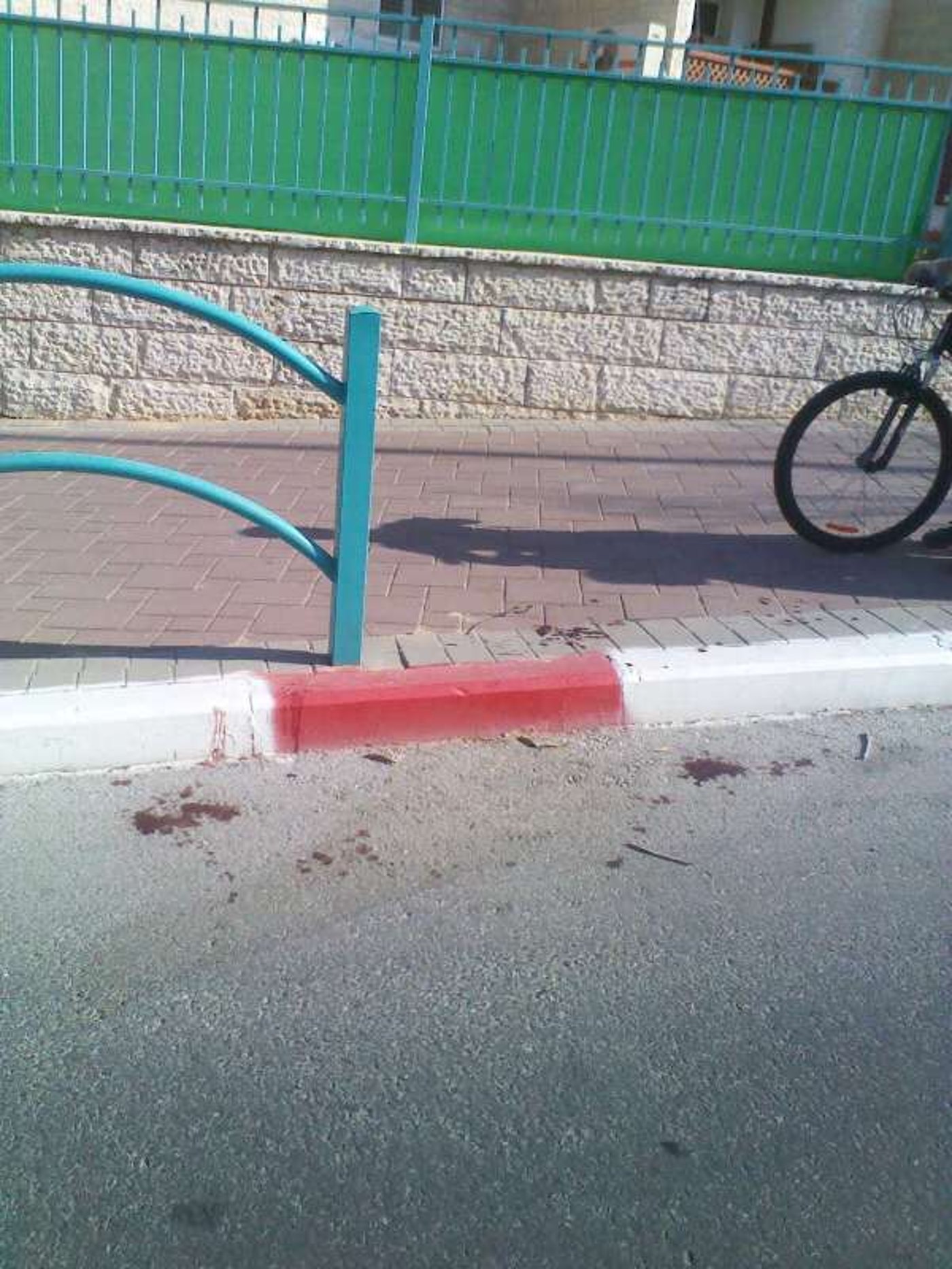 בית החולים 'שניידר': הילד מאלעד יצא מכלל סכנה
