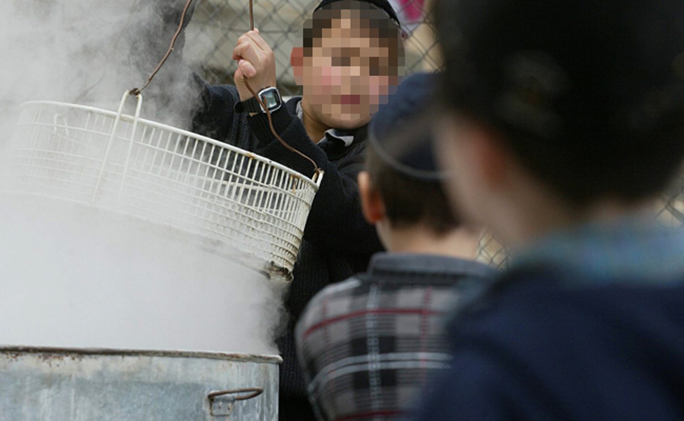 אלעד: ילד בן 5 נכווה כשהכין מנה חמה