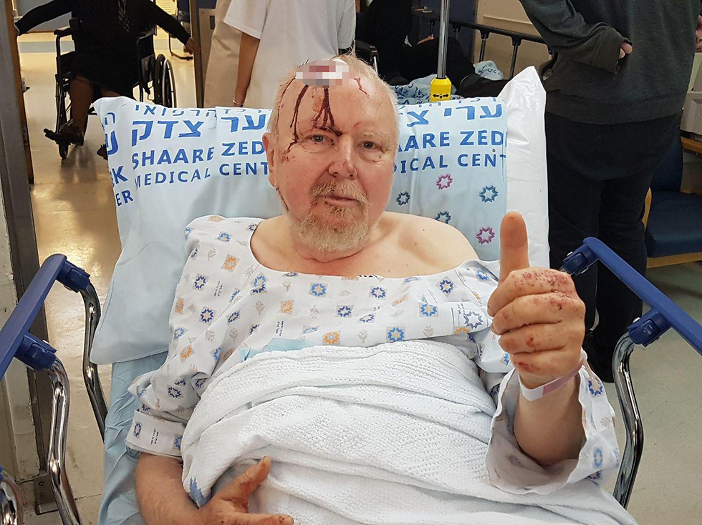 פצוע פיגוע הדריסה: "המחבל חייך ופגע בי"