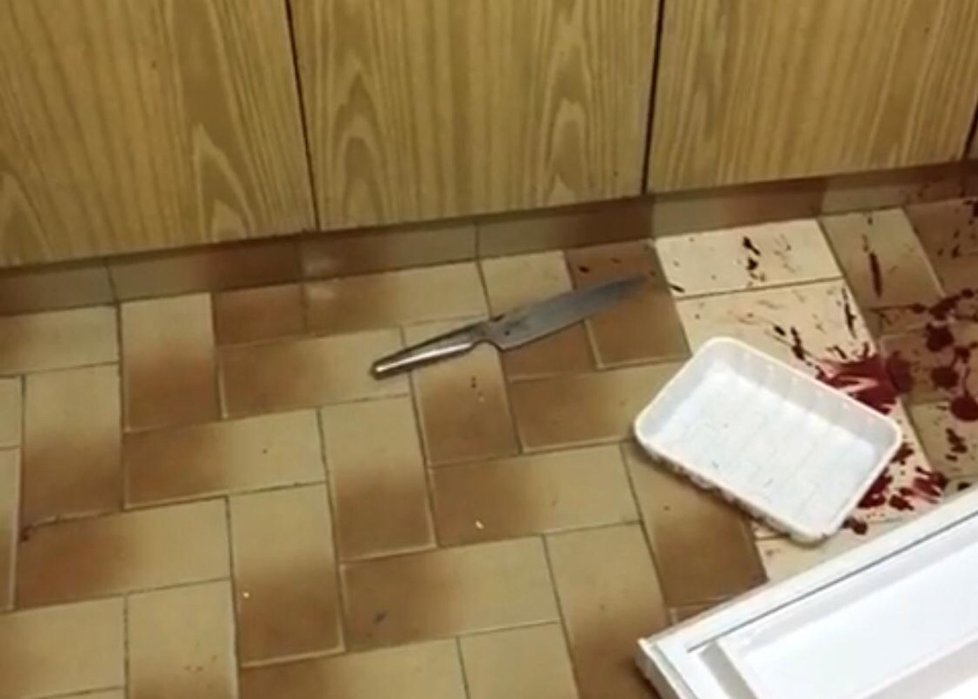 הסכין וכתמי הדם