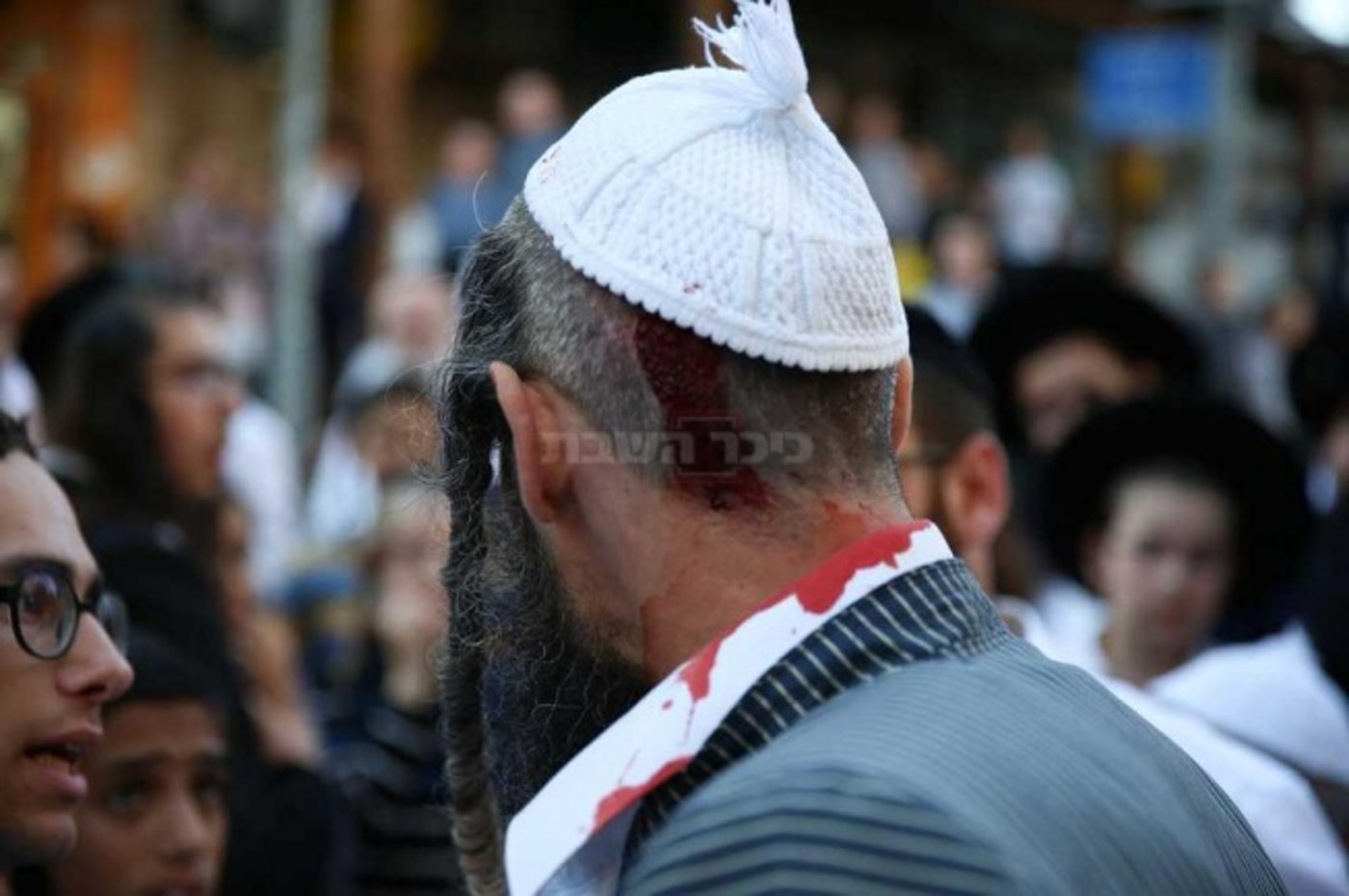 הפצוע