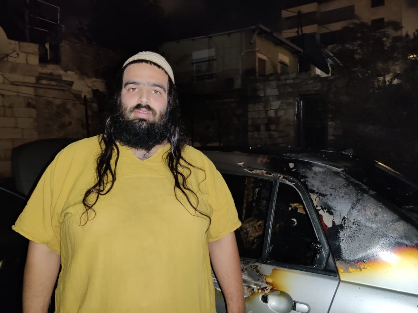 "לערבים בירושלים אין פחד": שרפו לרחמים שלושה רכבים