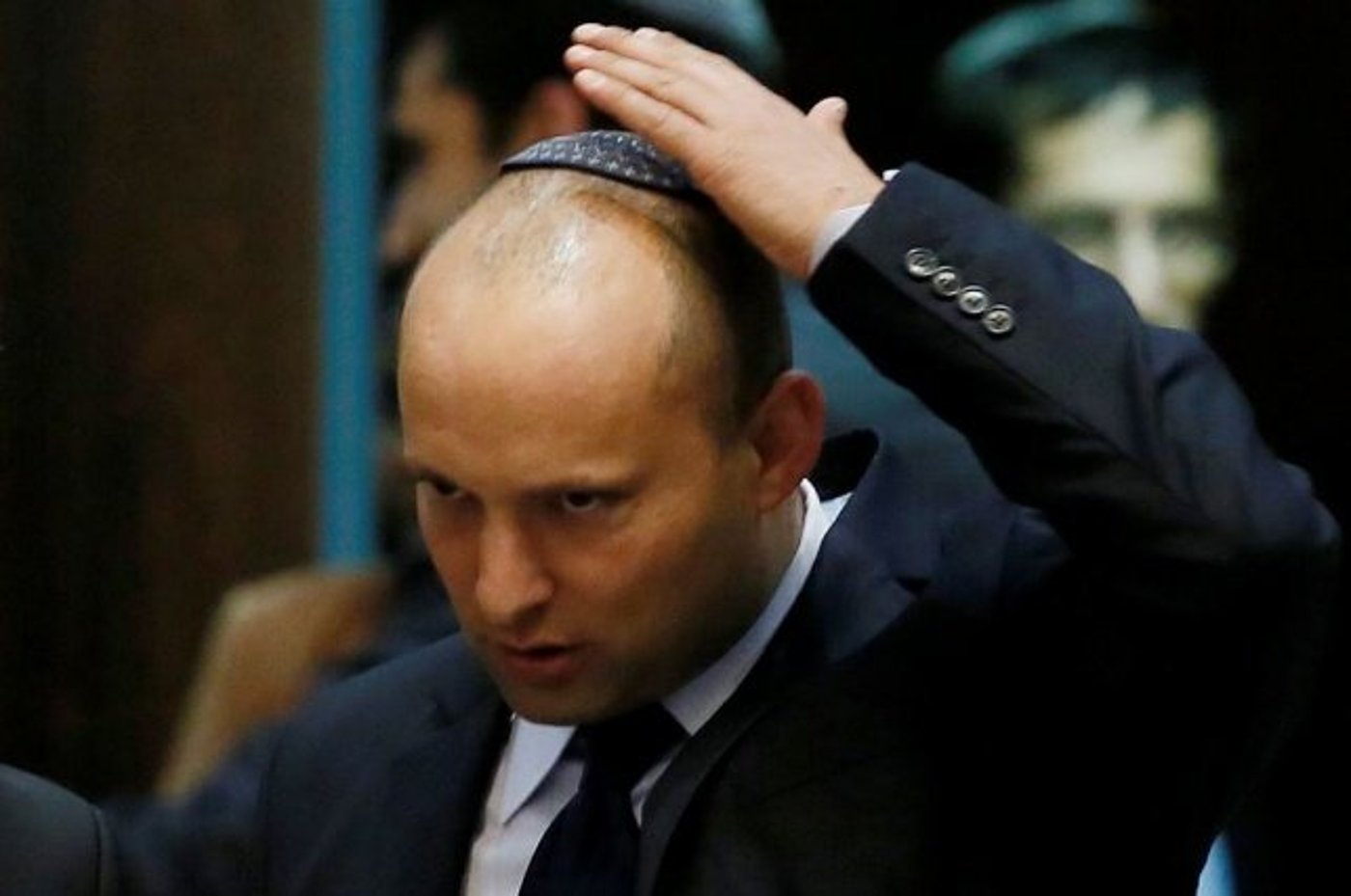 התקרחות מגיל צעיר: מדוע זה קורה?