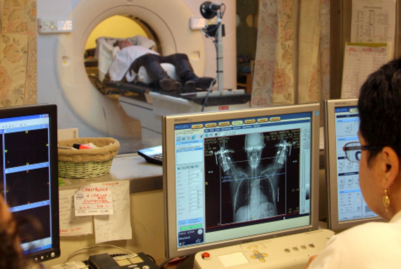 מכשיר CT