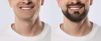 יותר ויותר גברים בוחרים להגיע לאפילוגיק