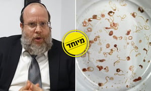 האם יש תולעי 'אניסקיס' בדגים? • צפו ולמדו