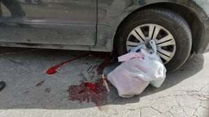 ילדה חרדית כבת 3 נפצעה קשה בתאונה בבית ישראל