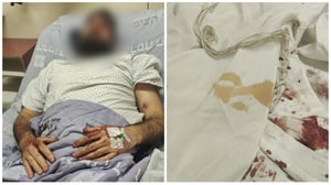 2 אחים הותקפו בידי פועלים ערבים ונפצעו