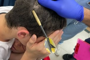 לא קלע למטרה: חץ ננעץ בראשו של נער בן 12