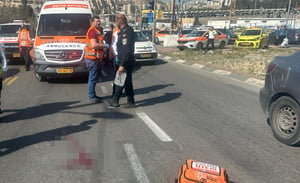 תאונת דרכים בשכונת רמות בירושלים: בחור ישיבה במצב קשה