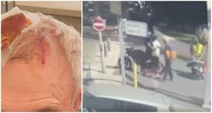 תיעוד התקיפה וראשו של המבוגר הקורבן אחרי התקיפה