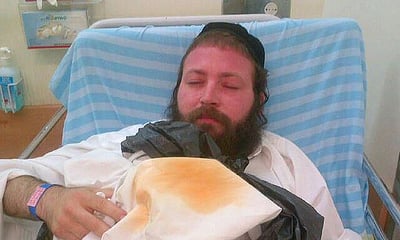 יוסי קלצקין לאחר שהותקף