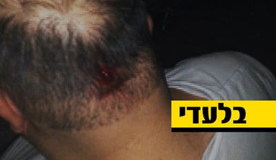שוד במיאמי: הרב לסרי ועוזריו הותקפו באקדח