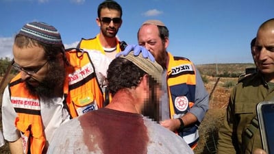 הפצוע מהטחת הסלע