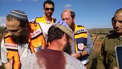 אחד הפצועים בלינץ'