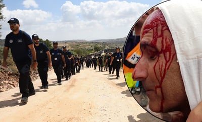 המשטרה: נתקלנו באלימות חמורה • תיעוד