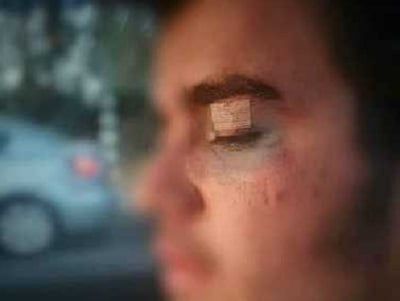הצעיר החרדי, לאחר התקיפה הלאומנית