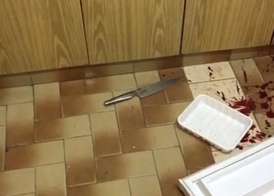 הסכין וכתמי הדם