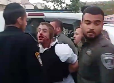 המכות לנער האוטיסט: כתם שאפשר למחות