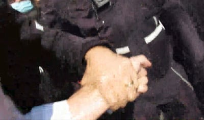 תיעוד המקרה הקשה