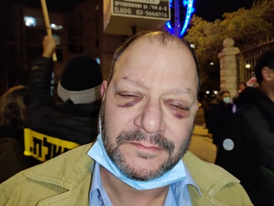 ח"כ עופר כסיף, הערב