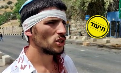 ניצול הלינץ' משחזר: "חטפנו, עד ששוטר אחד הציל אותנו"