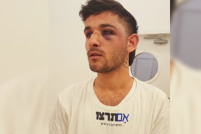 פעיל ימין טוען כי הותקף באלימות בהפגנת תמיכה ברפורמה המשפטית