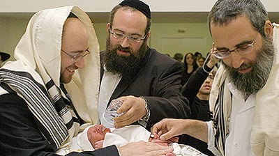 ברית מילה.