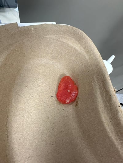 פרוסת האבטיח שחולצה