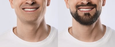 יותר ויותר גברים בוחרים להגיע לאפילוגיק