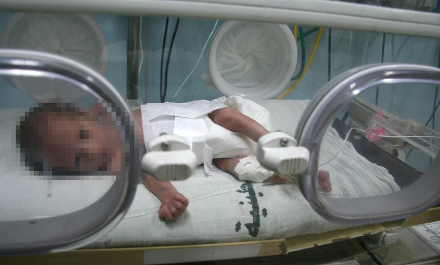 תינוקת מונשמת בבית החולים