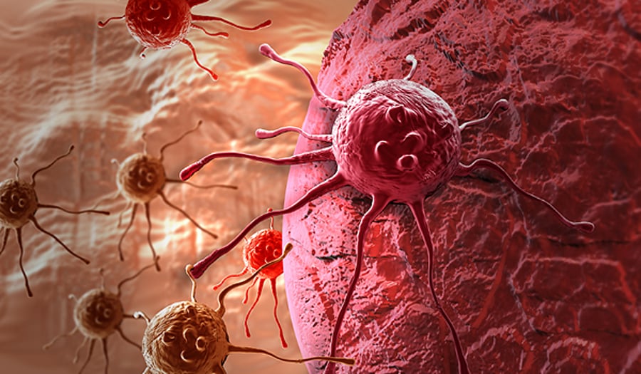 הדמיה של תאי סרטן