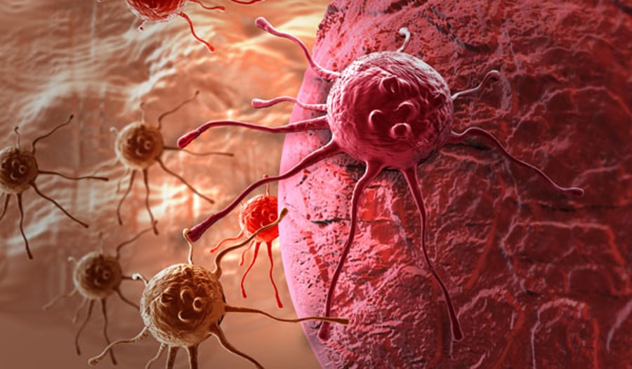 הדמייה של תאים סרטניים