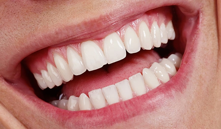 השיטות הטבעיות לשמור על השיניים