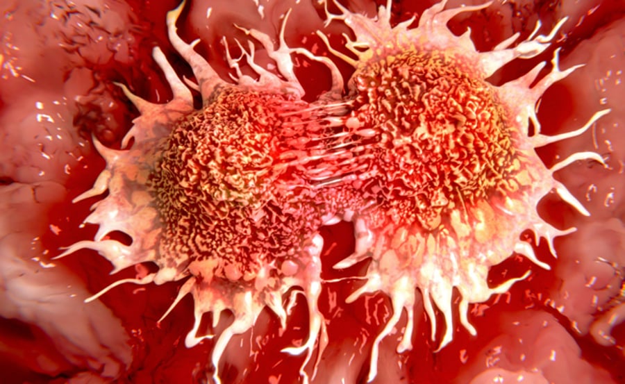 החוקרים טוענים: מצאנו דרך "לכבות" את מחלת הסרטן