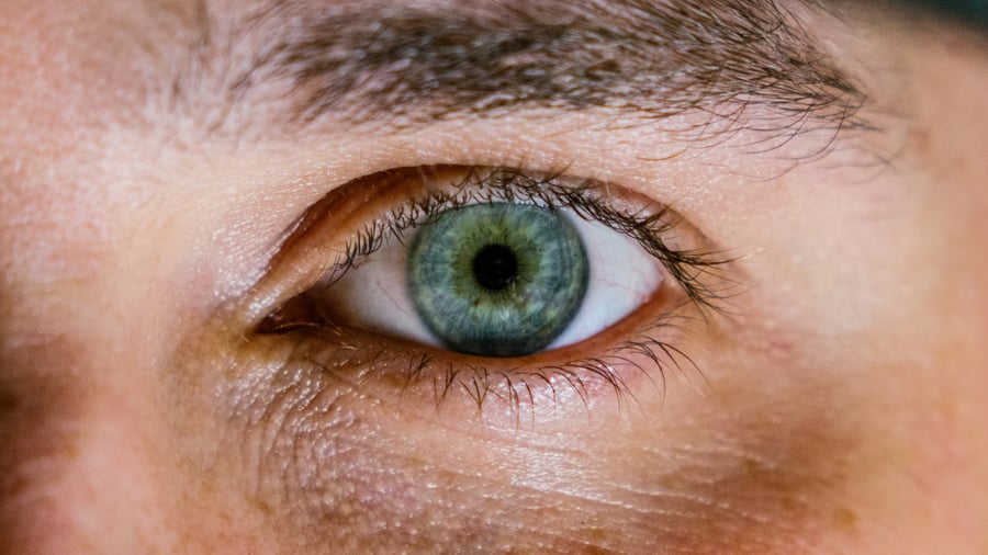 8 סיבות מדוע יש לכם עיגולים שחורים סביב העיניים