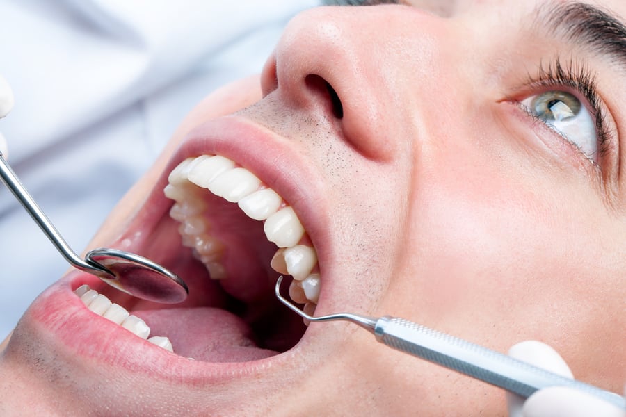 רופא השיניים ביטל את השיק לאחר הפסקת העבודות. אילוסטרציה