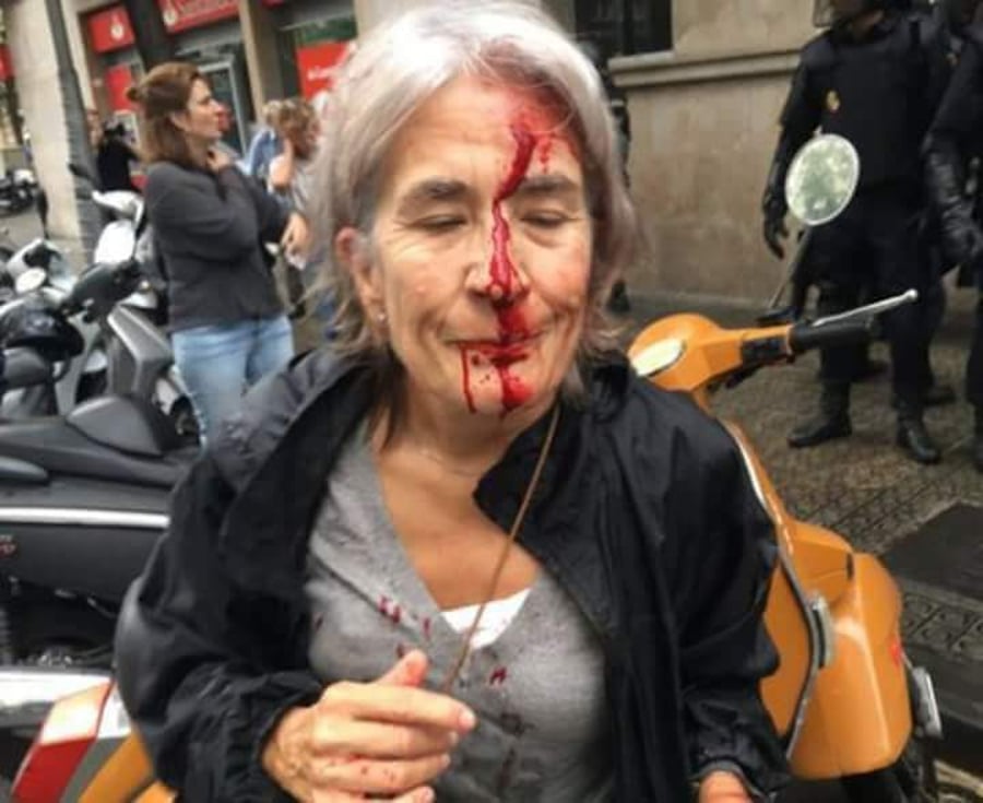 דם ברחובות קטלוניה: כדורי גומי על אזרחים