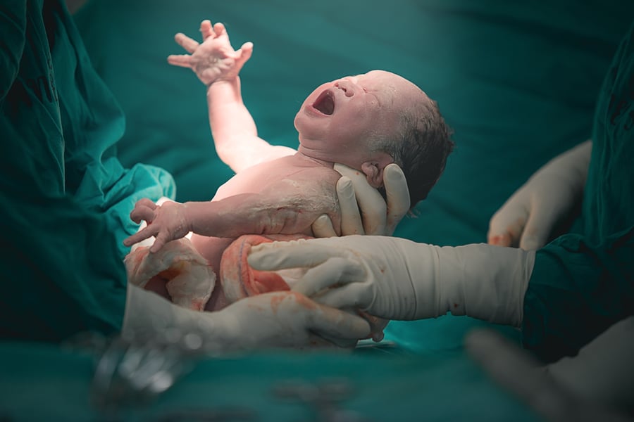 בוצעה לידת וואקום והתינוק נולד עם שיתוק מוחין