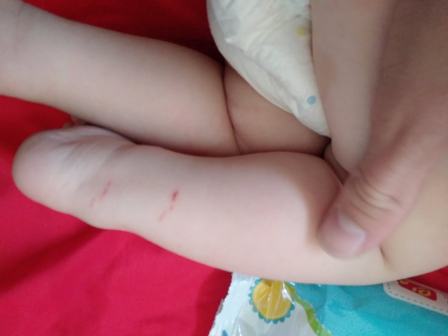 משפחה חרדית הותקפה; תינוק נשרט בידו מזכוכיות