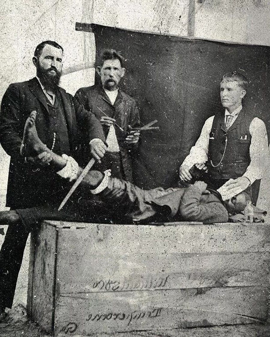 אדם שחור 'מנודב' בעל כרחו לניסויים רפואיים בחומר ה'אתר', שנות ה-1850